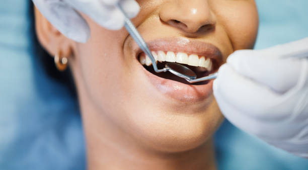 Best Urgent Care for Lost Fillings or Crowns in St Paul, VA